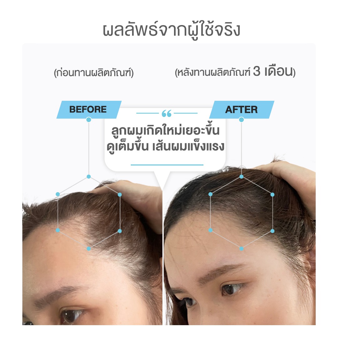 สั่งซื้อสินค้าออนไลน์จาก Bevita official store | Shopee Thailand