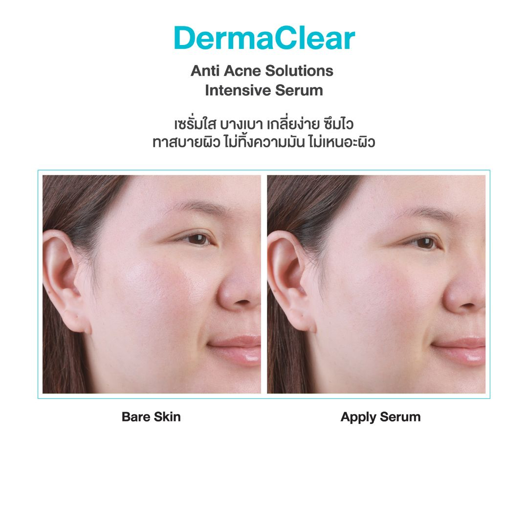 DermaClear Official, ร้านค้าออนไลน์ | Shopee Thailand